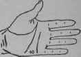 Laryngitis 167