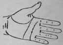 Oppression Of The Heart Consequence Of A Severe Li 706