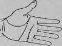 Oppression Of The Heart Consequence Of A Severe Li 708
