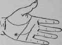 Oppression Of The Heart Consequence Of A Severe Li 711