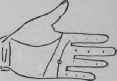 Oppression Of The Heart Consequence Of A Severe Li 712
