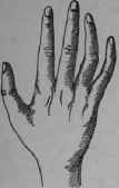 Types Of Hand