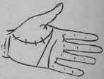 VIII Bars Capillaries And Signs 297