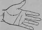 VIII Bars Capillaries And Signs 299