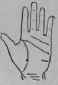 VIII Bars Capillaries And Signs 301