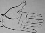 VIII Bars Capillaries And Signs 305
