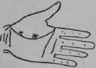 VIII Bars Capillaries And Signs 310