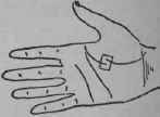 VIII Bars Capillaries And Signs 313
