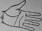 VIII Bars Capillaries And Signs 316