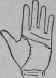 VIII Bars Capillaries And Signs 317