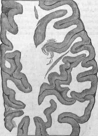 Portion of Eight Hemisphere of the Human Brain, divided horizontally, showing the convolutions, and arrangement of white and gray matter.