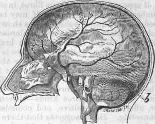 The Brain enclosed in the Dura Mater.