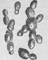Saccharomyces cerevisisB Yeast of sedimentary beer, budding, magnified 400 diameters.